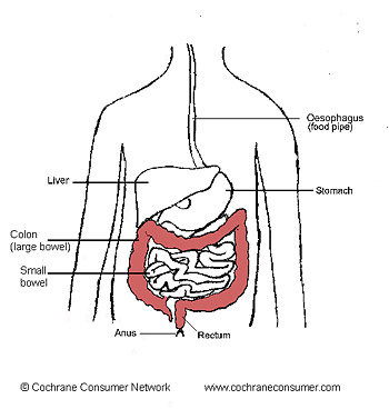 полипы кишечника полипы кишечника