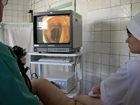 Видеоколоноскопия